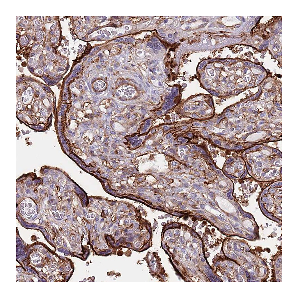 Atlas Antibodies Anti-RNF144A Antibody