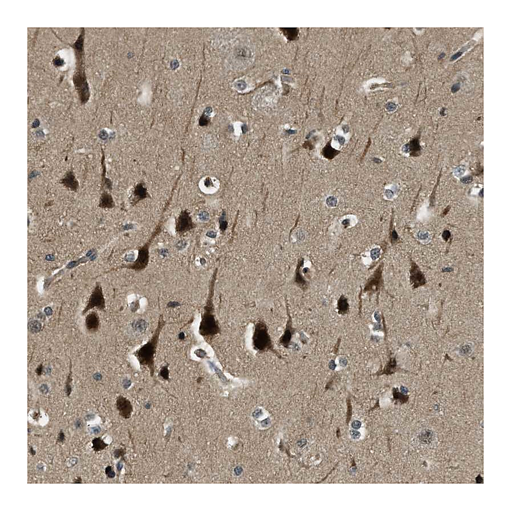 Atlas Antibodies Anti-RNF141 Antibody