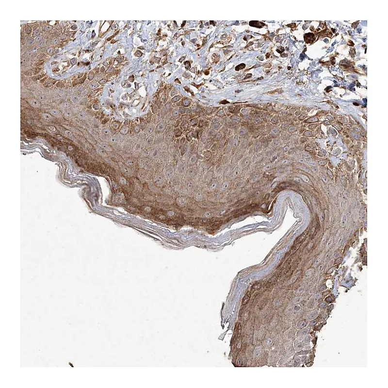 Atlas Antibodies Anti-RNF145 Antibody
