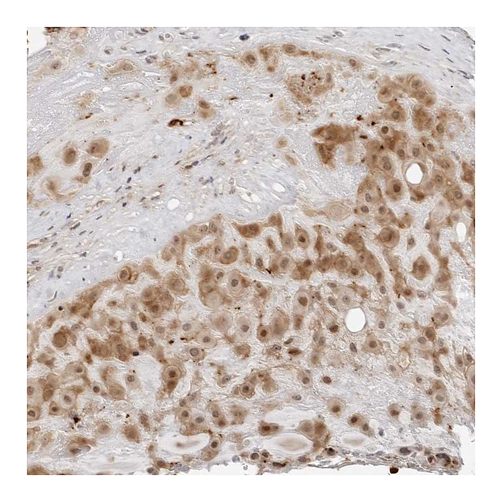 Atlas Antibodies Anti-RNF146 Antibody