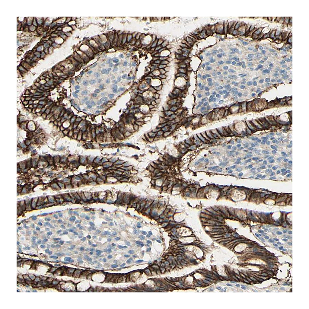 Atlas Antibodies Anti-RNF149 Antibody