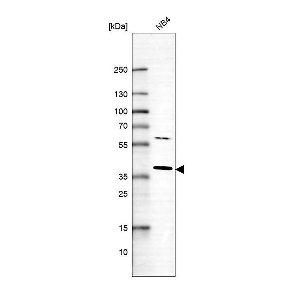 Atlas Antibodies Anti-RNF166 Antibody