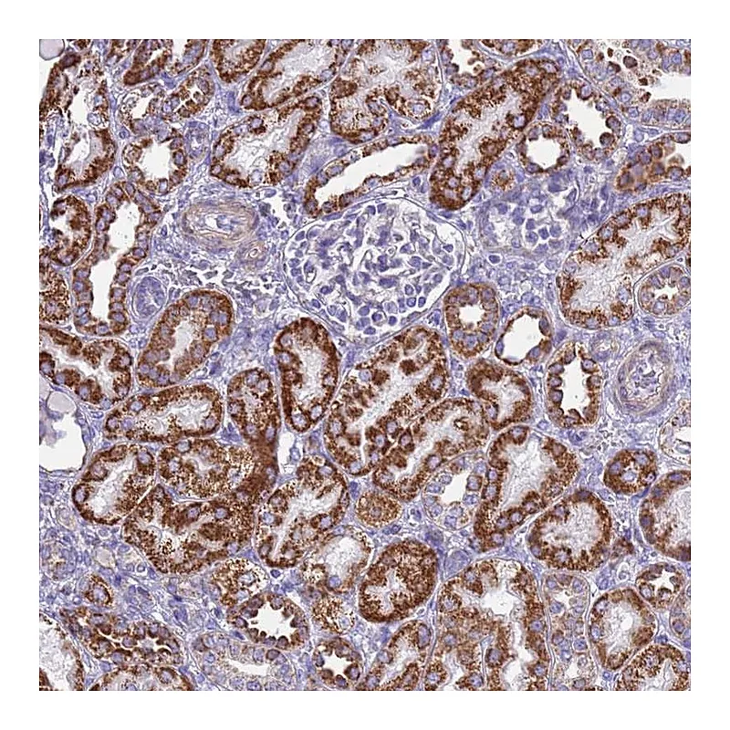 Atlas Antibodies Anti-RNF165 Antibody