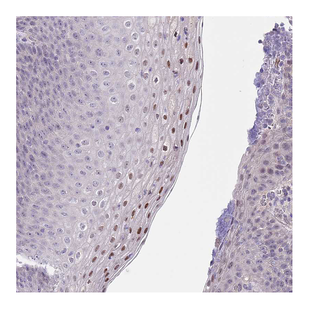 Atlas Antibodies Anti-RNF169 Antibody