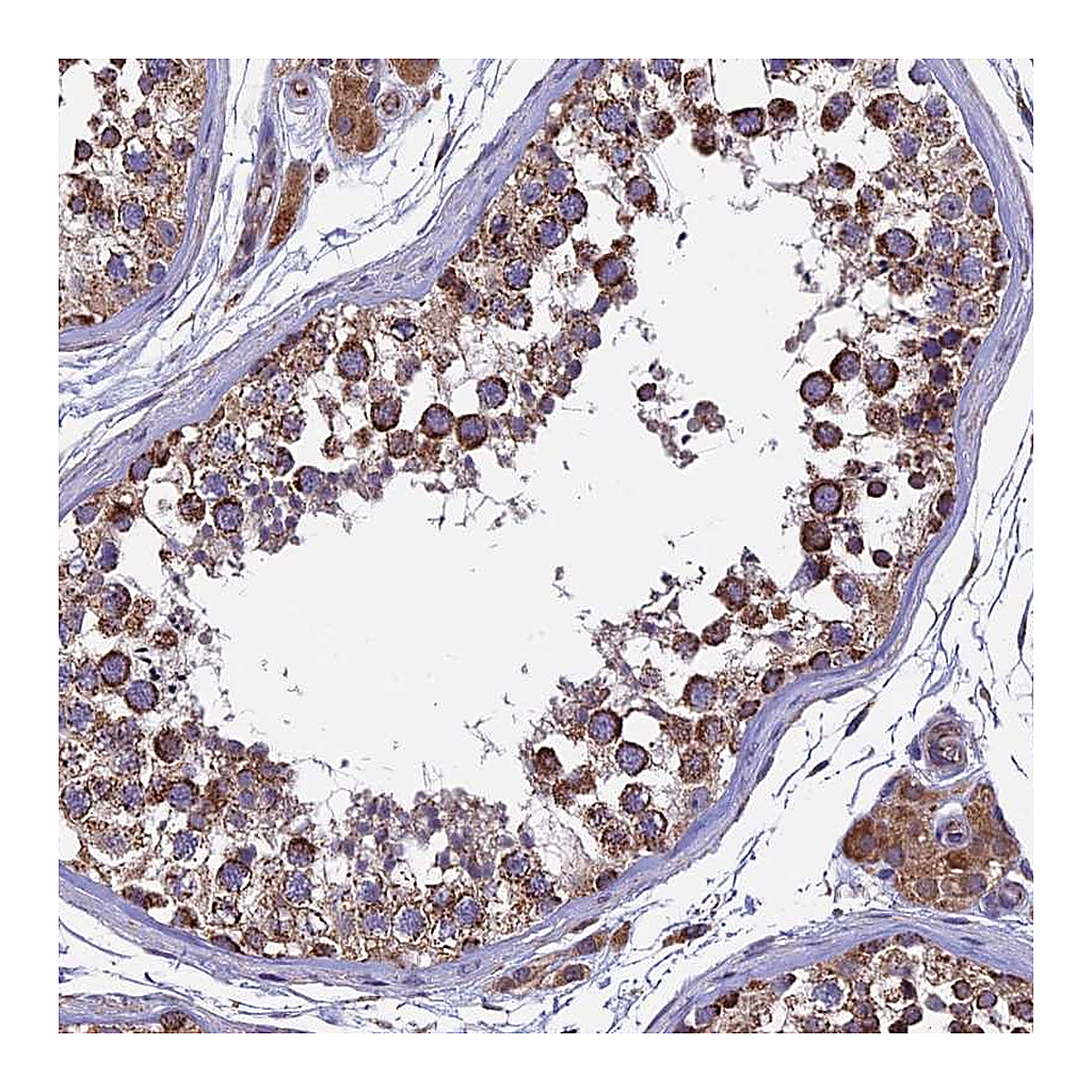 Atlas Antibodies Anti-RNF17 Antibody