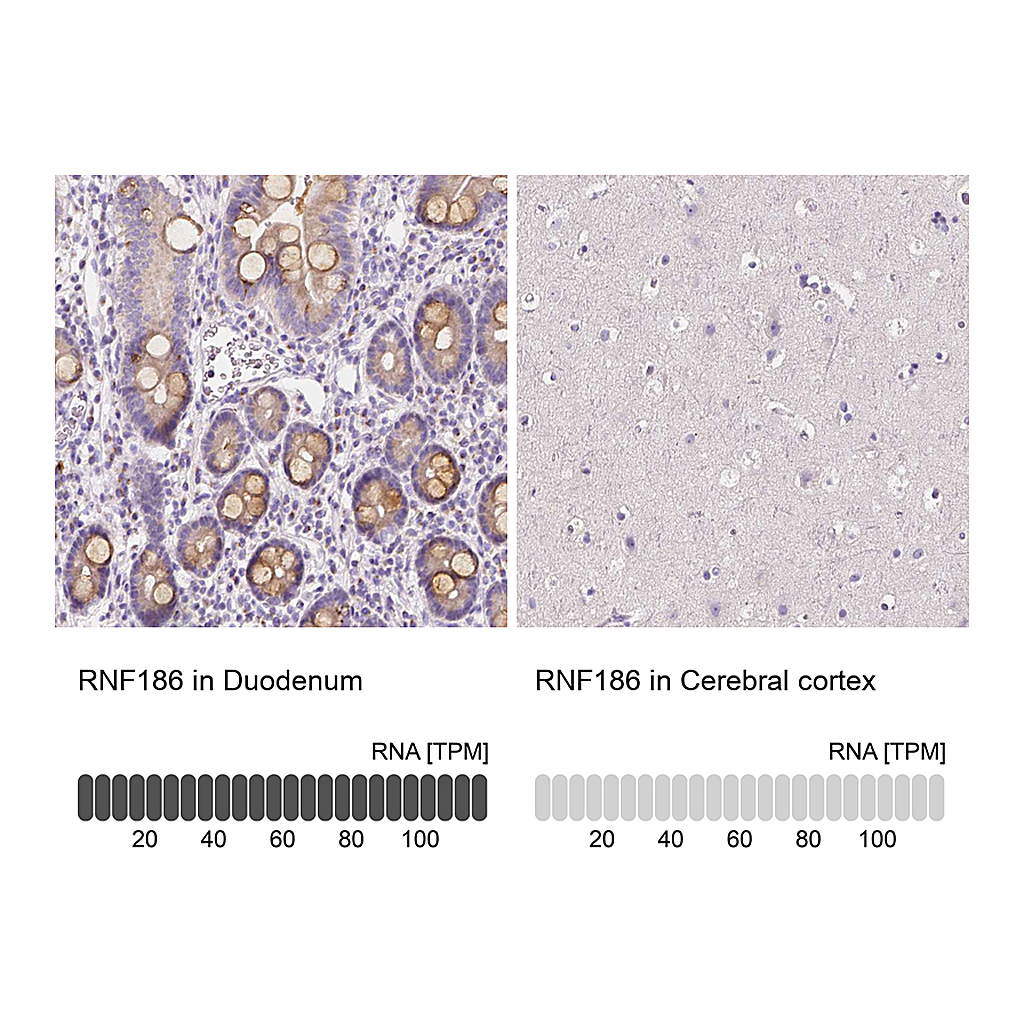 Atlas Antibodies Anti-RNF186 Antibody