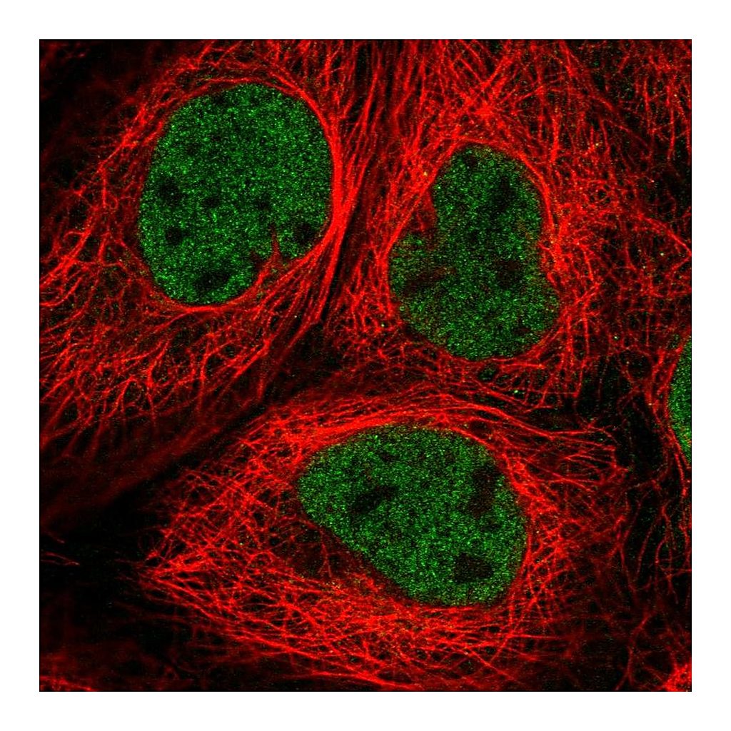 Atlas Antibodies Anti-RNF20 Antibody