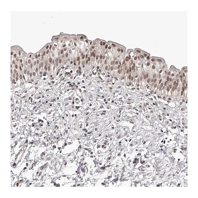 Atlas Antibodies Anti-RNF2 Antibody