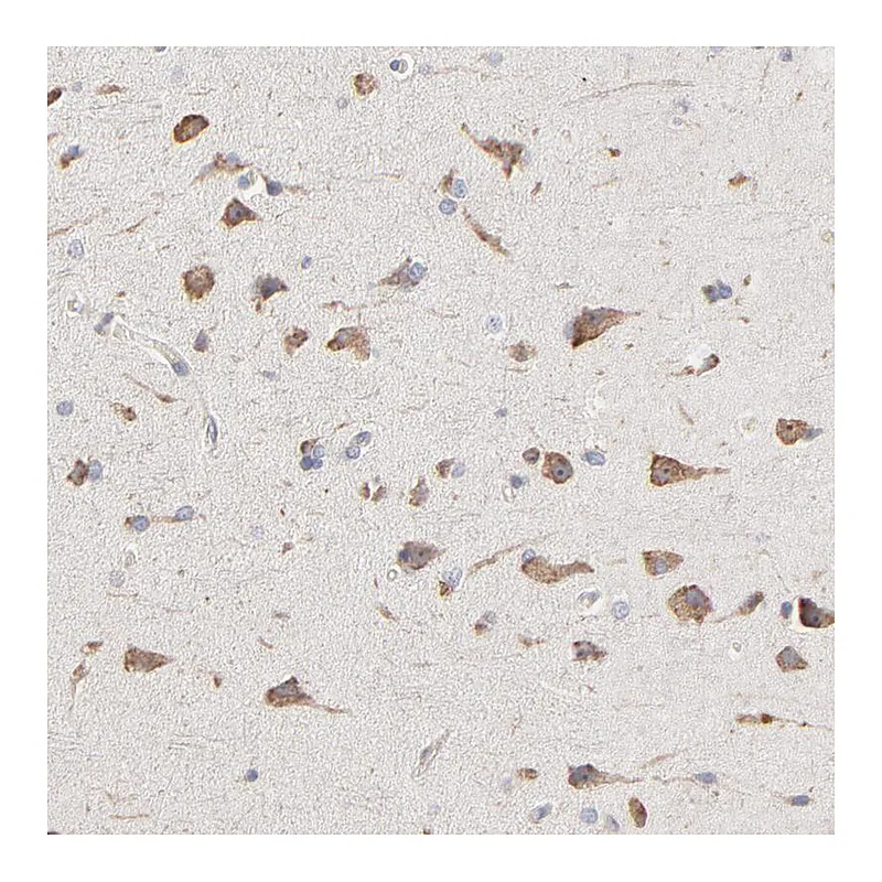 Atlas Antibodies Anti-RNF213 Antibody