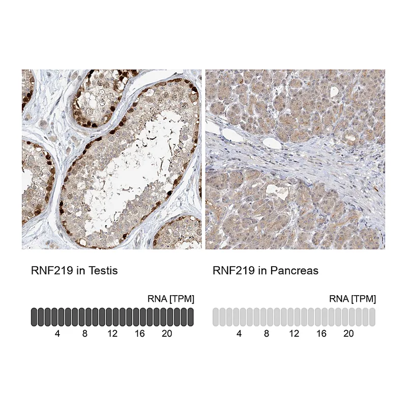 Atlas Antibodies Anti-RNF219 Antibody