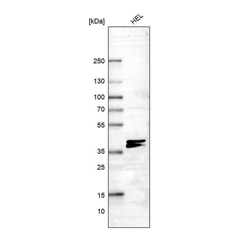Atlas Antibodies Anti-RNF220 Antibody