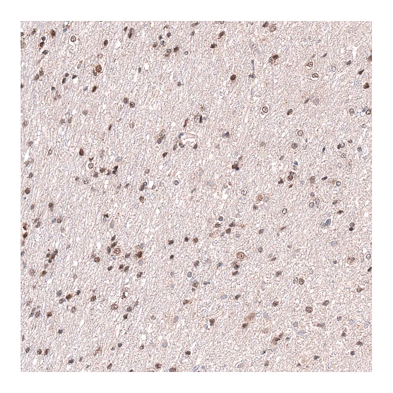 Atlas Antibodies Anti-RNF220 Antibody