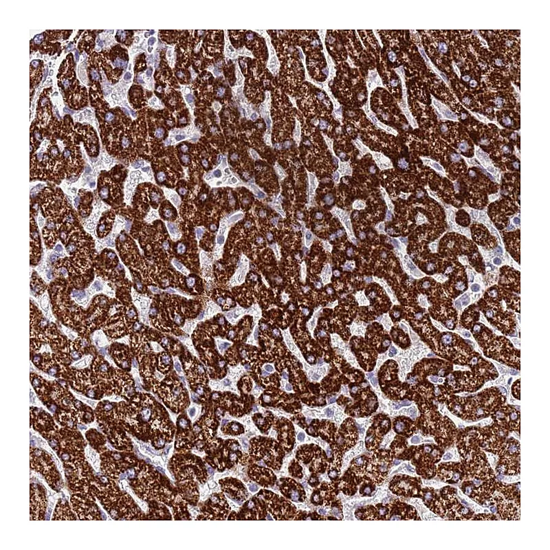 Atlas Antibodies Anti-RNF222 Antibody