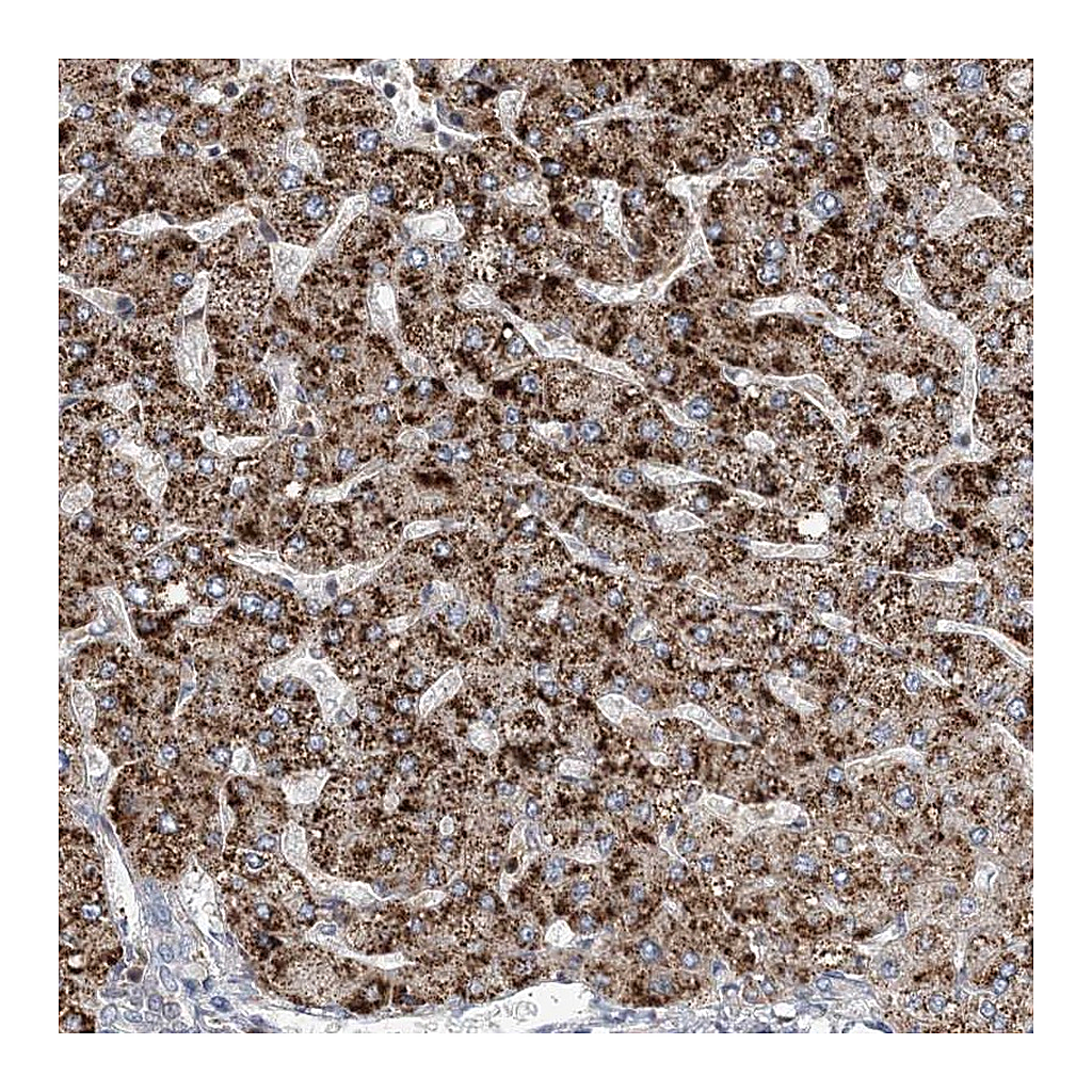 Atlas Antibodies Anti-RNF25 Antibody