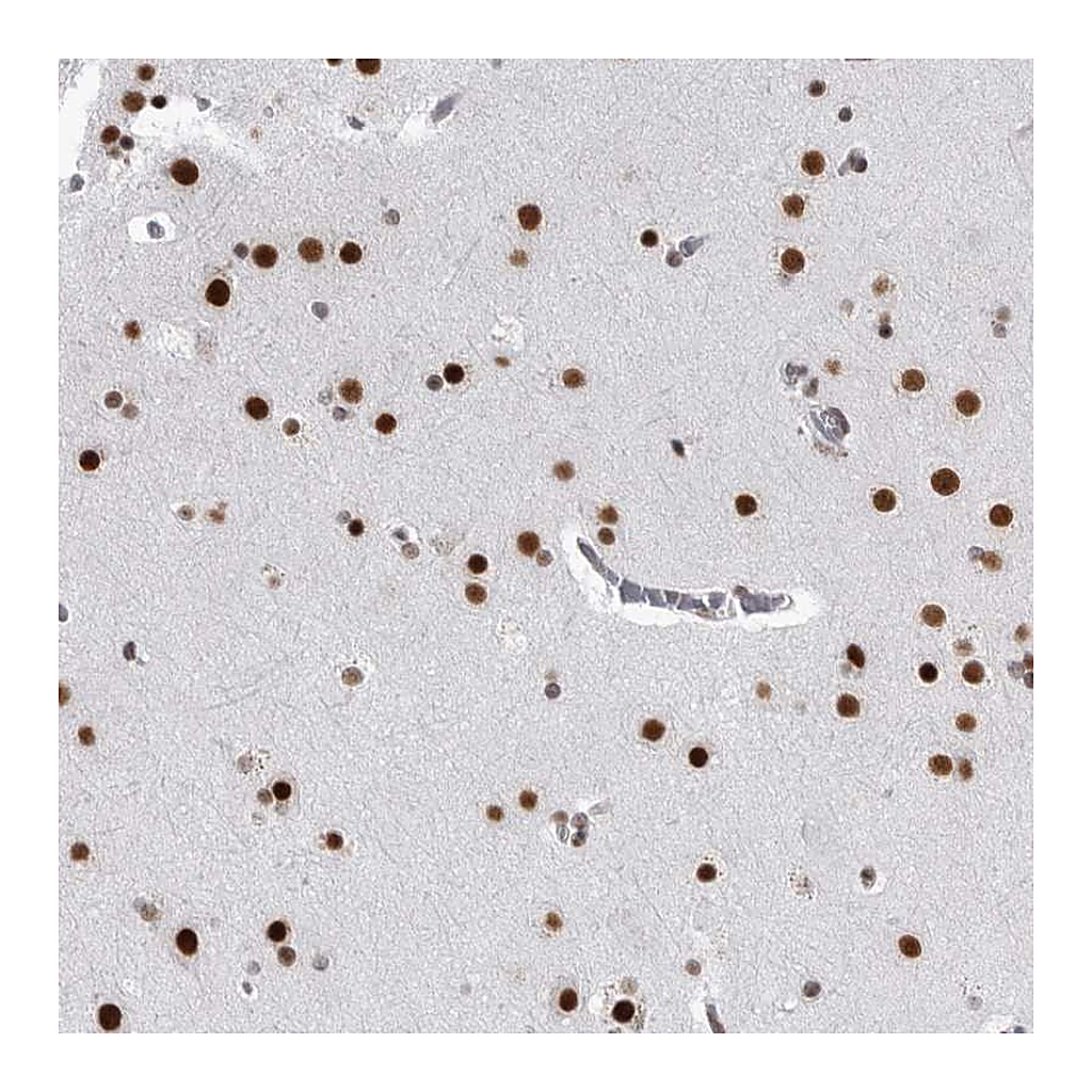 Atlas Antibodies Anti-RNF26 Antibody