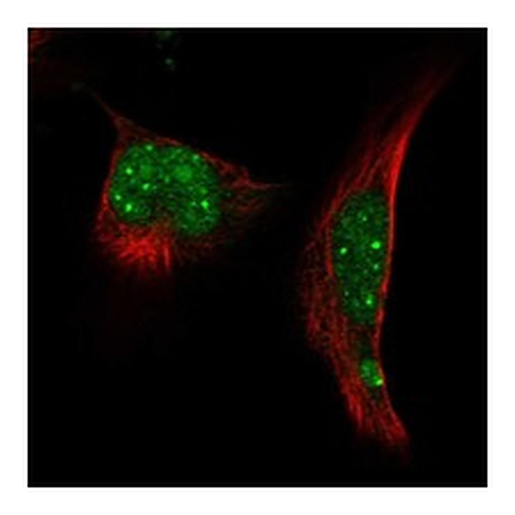 Atlas Antibodies Anti-RNF4 Antibody
