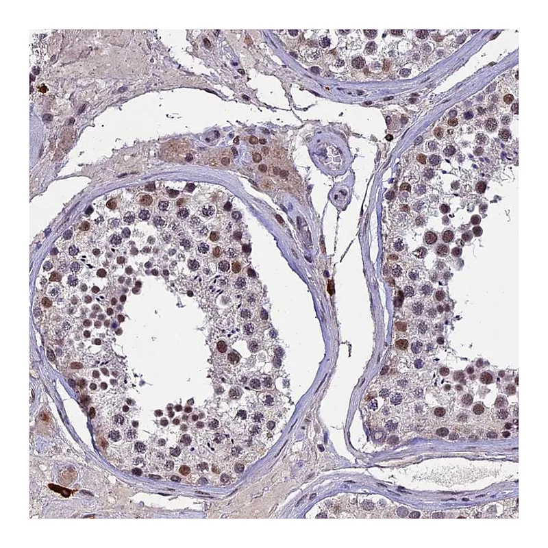 Atlas Antibodies Anti-RNF40 Antibody