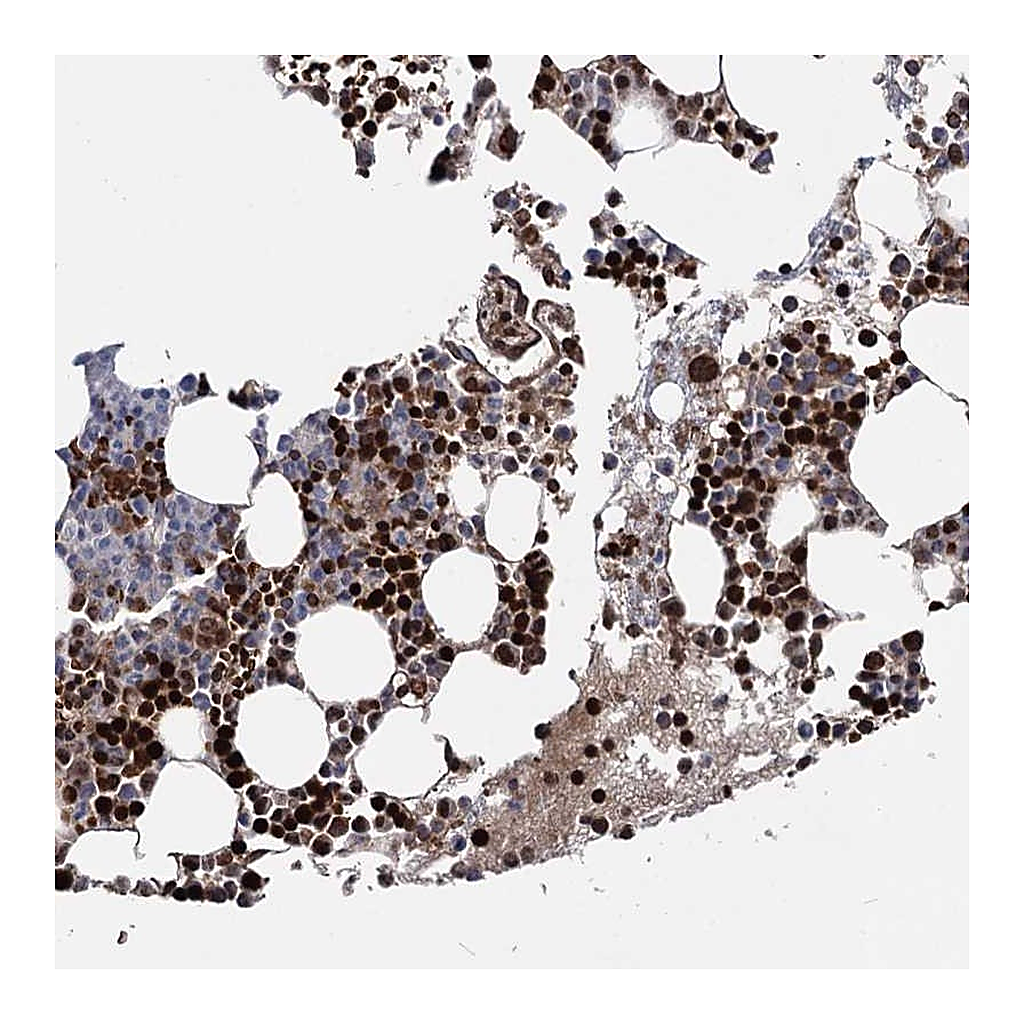Atlas Antibodies Anti-RNF6 Antibody