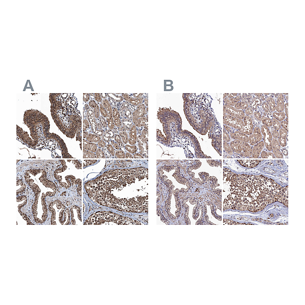 Atlas Antibodies Anti-RNH1 Antibody