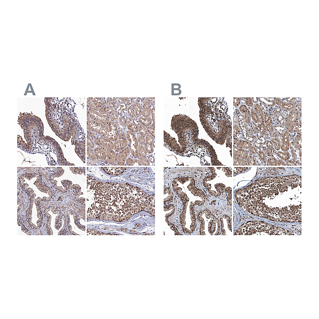 Atlas Antibodies Anti-RNH1 Antibody