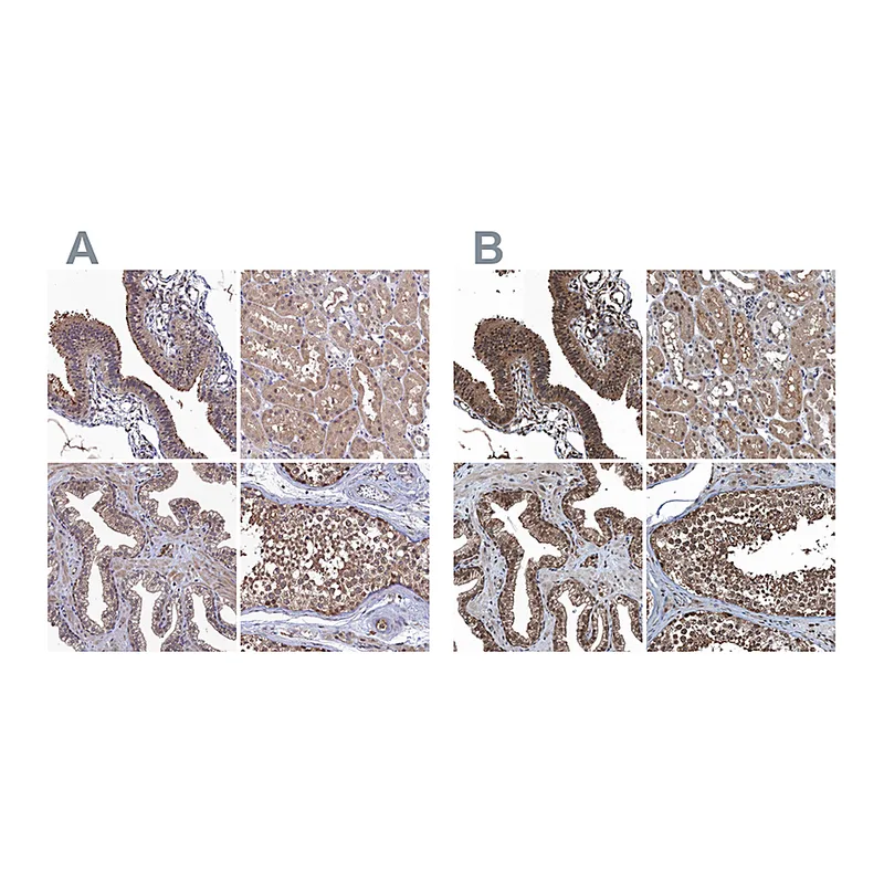 Atlas Antibodies Anti-RNH1 Antibody