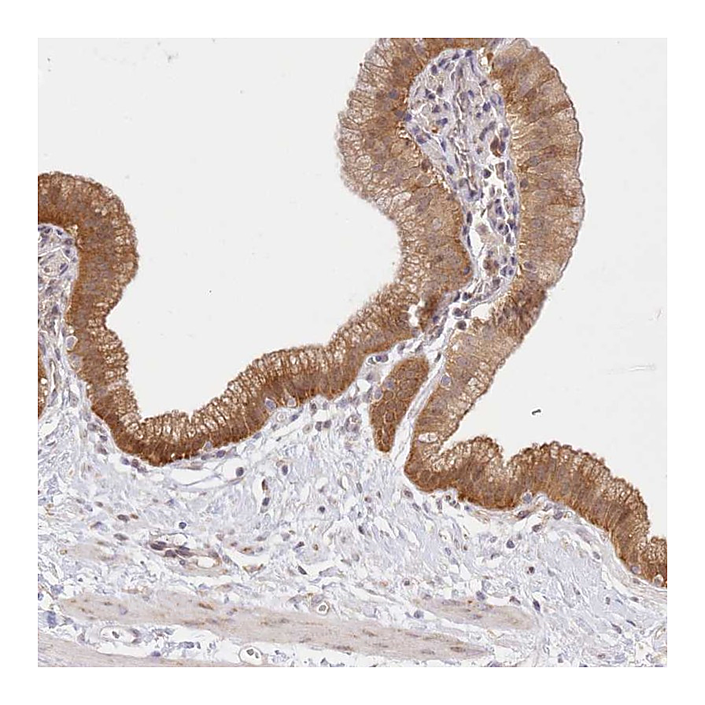 Atlas Antibodies Anti-RNPEP Antibody