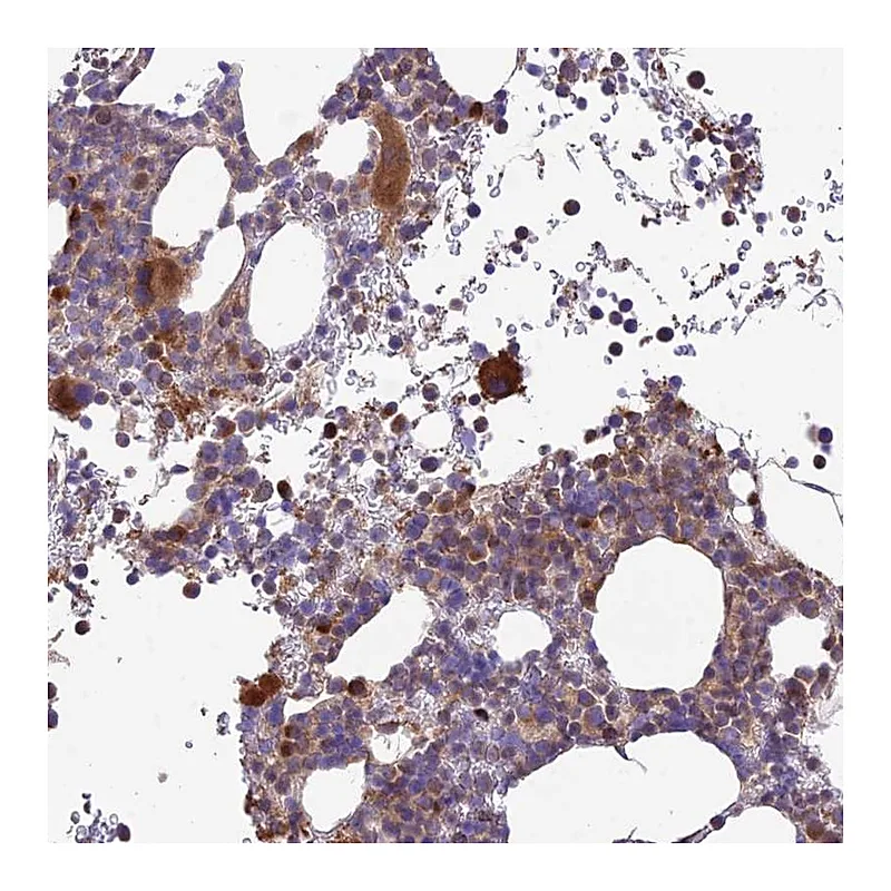 Atlas Antibodies Anti-ROCK1 Antibody