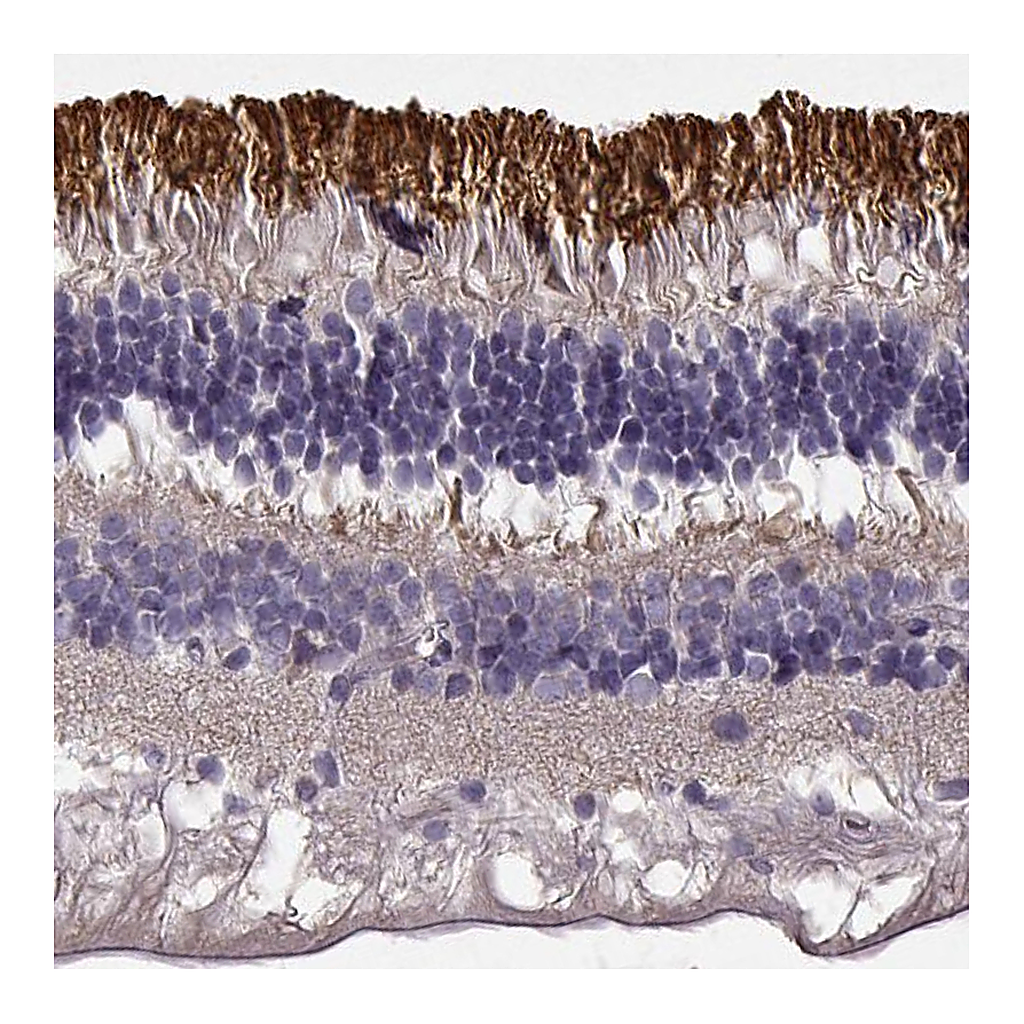 Atlas Antibodies Anti-ROM1 Antibody