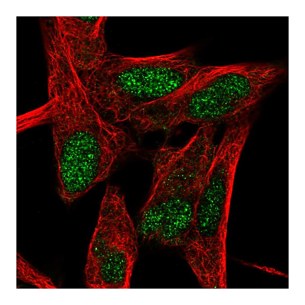 Atlas Antibodies Anti-RORB Antibody