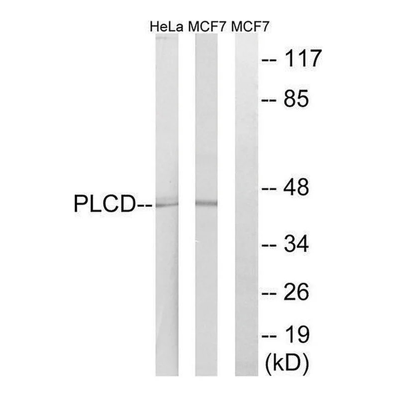 Merck Anti-AGPAT4 antibody produced in rabbit