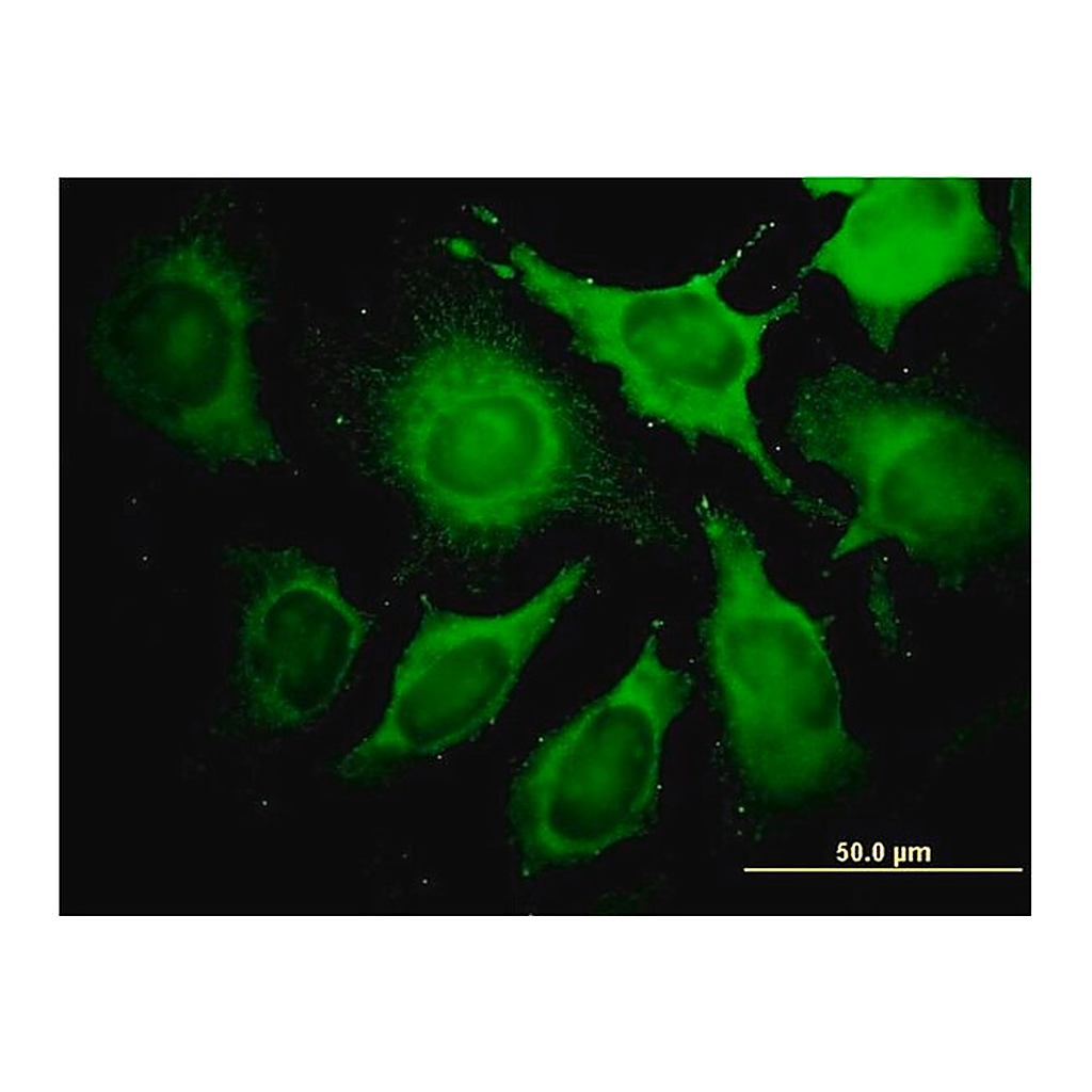 Merck Monoclonal Anti-ALDOA antibody produced in mouse