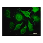 Merck Monoclonal Anti-ALDOA antibody produced in mouse