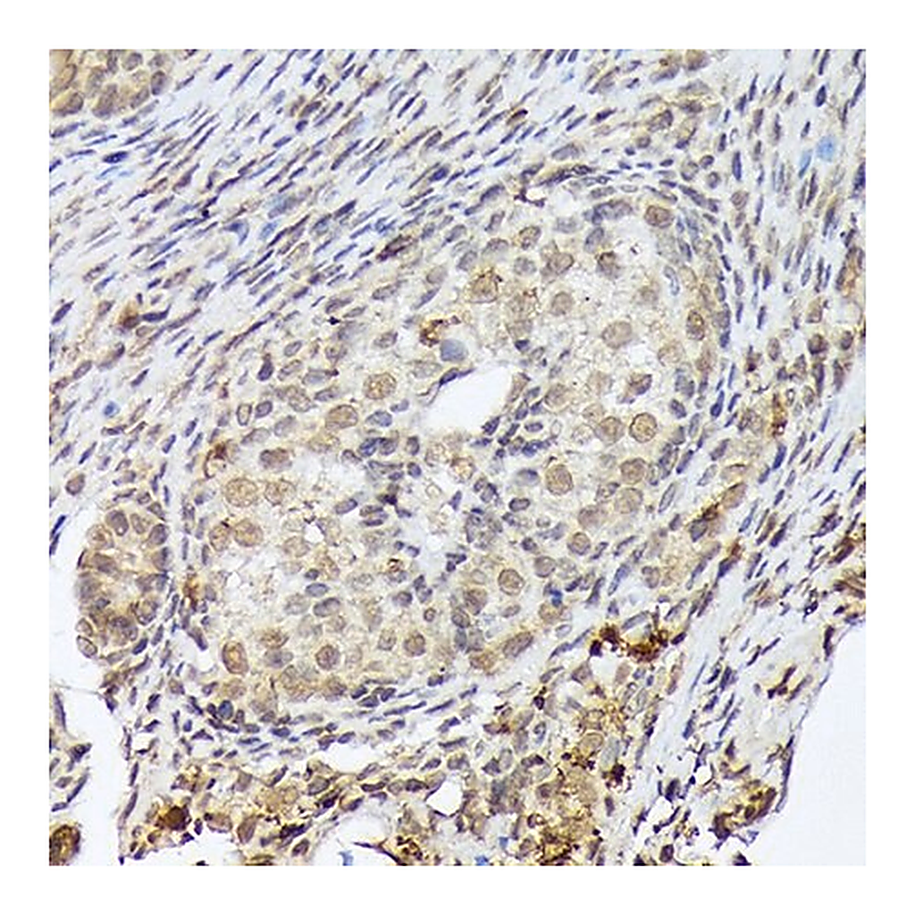 Merck Anti-PSMD14 antibody produced in rabbit