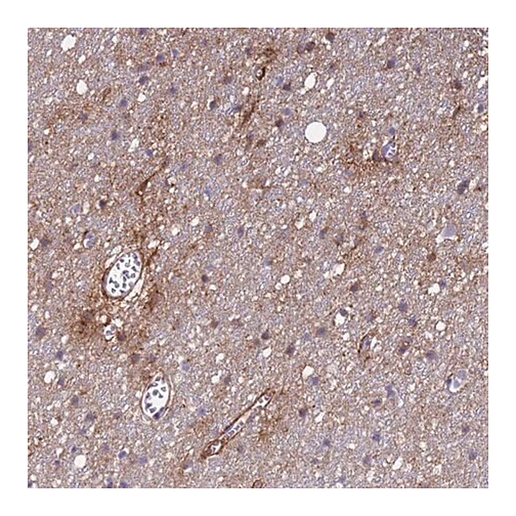 Merck Anti-P2RX7 antibody produced in rabbit