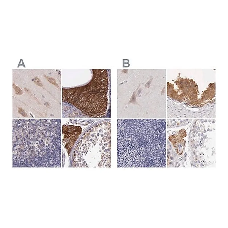 Merck Anti-NSDHL antibody produced in rabbit
