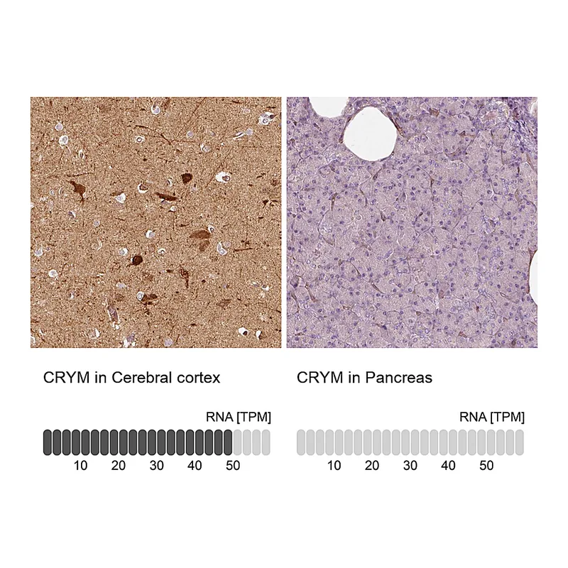 Atlas Antibodies Anti-CRYM Antibody