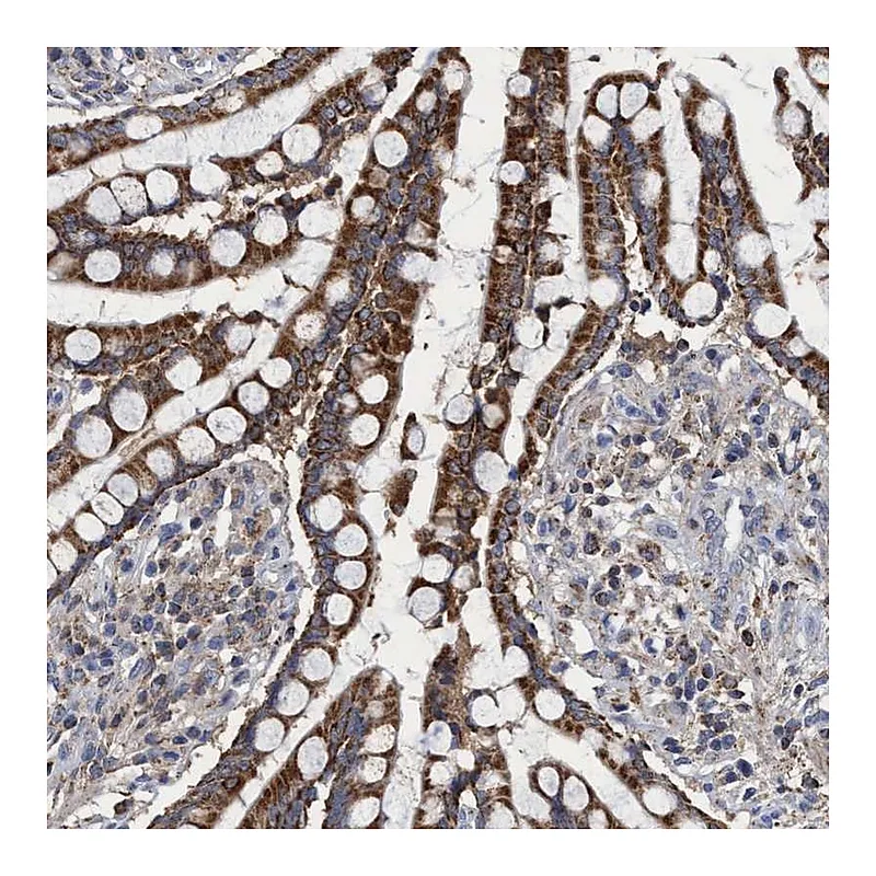 Atlas Antibodies Anti-CRYZ Antibody