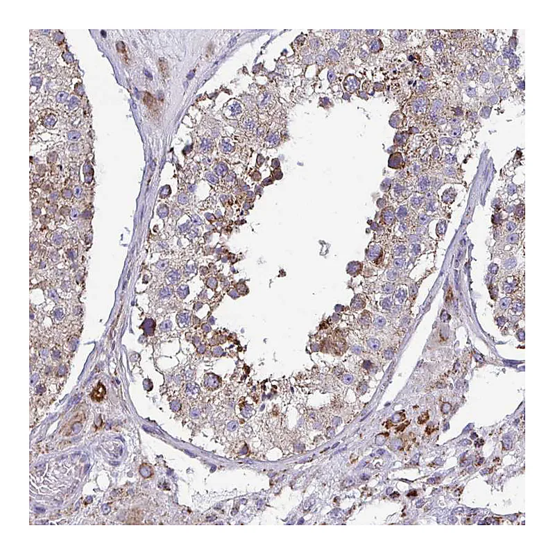 Atlas Antibodies Anti-CSDE1 Antibody