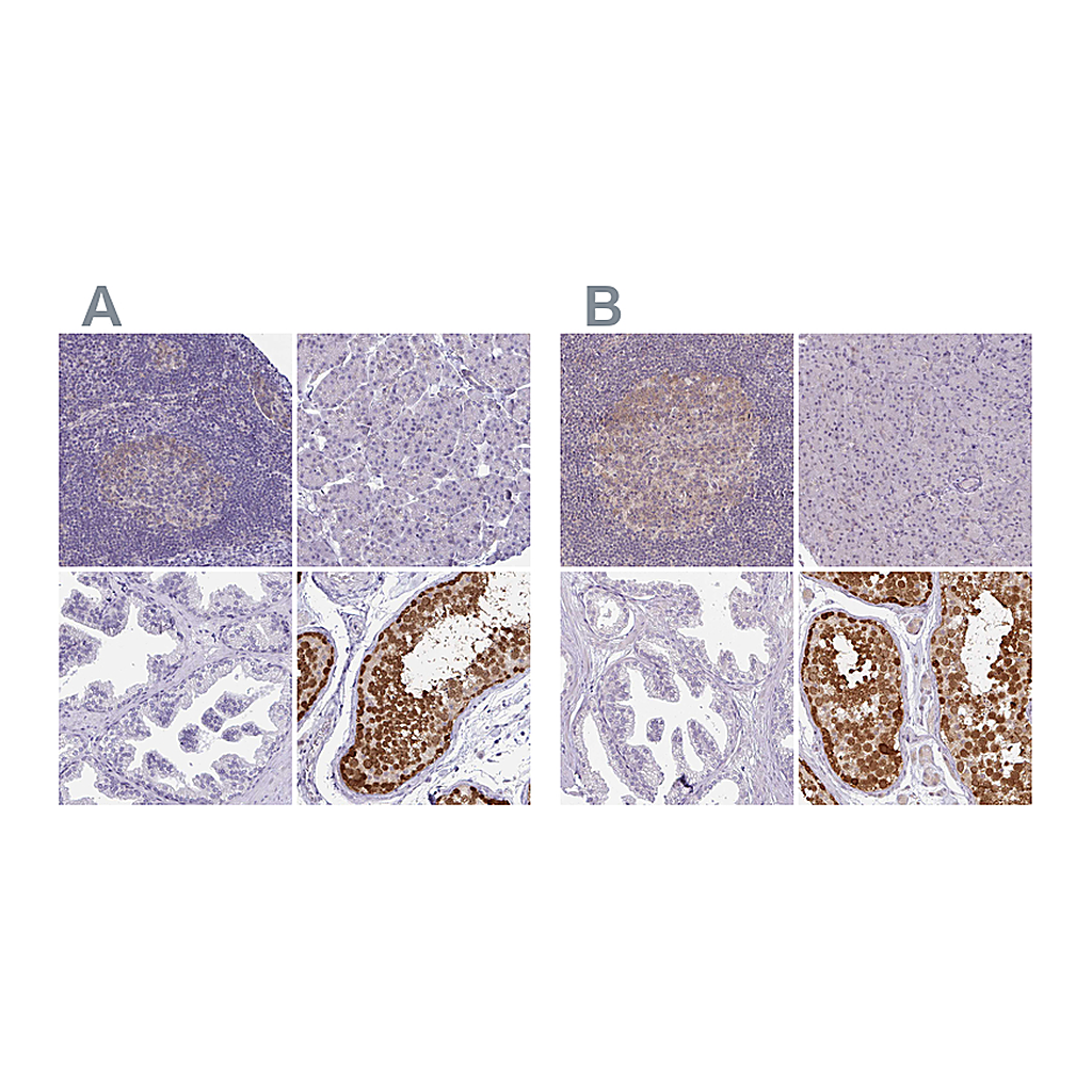 Atlas Antibodies Anti-CSE1L Antibody