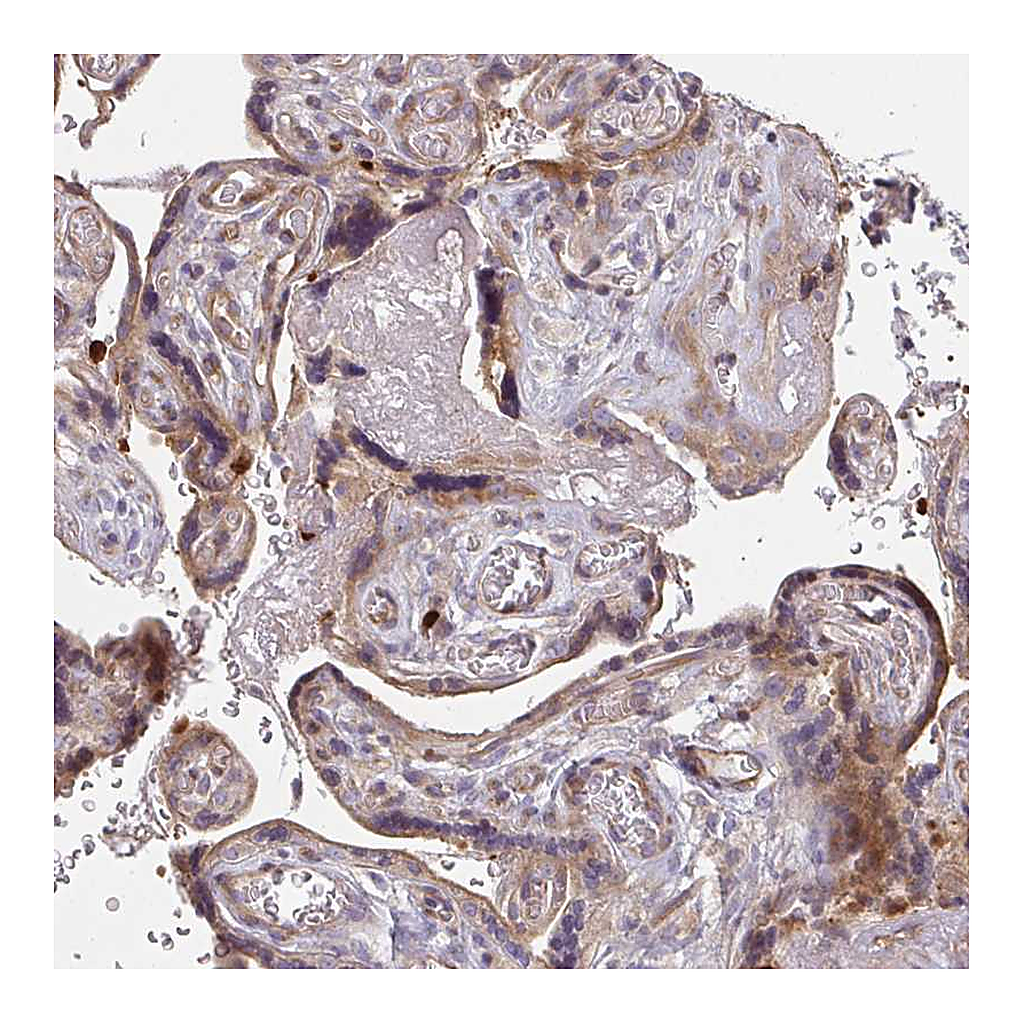 Atlas Antibodies Anti-CSF3R Antibody