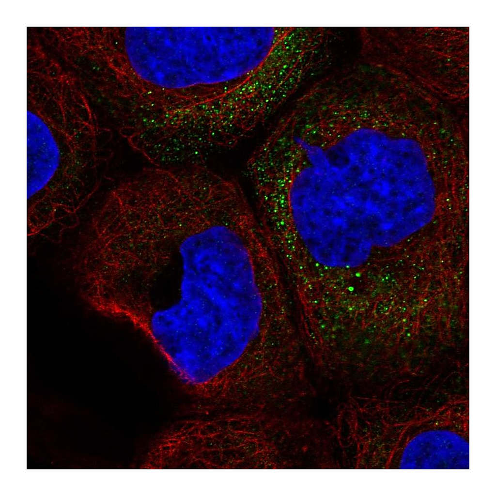 Atlas Antibodies Anti-CSF2 Antibody