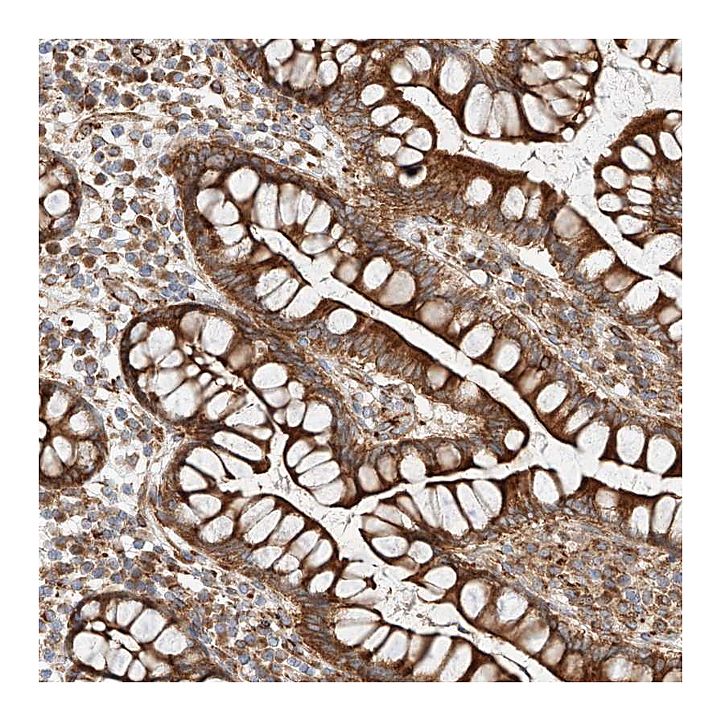 Atlas Antibodies Anti-CSGALNACT2 Antibody