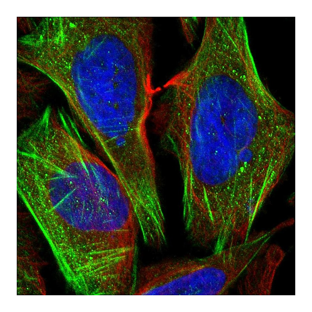 Atlas Antibodies Anti-CSGALNACT1 Antibody