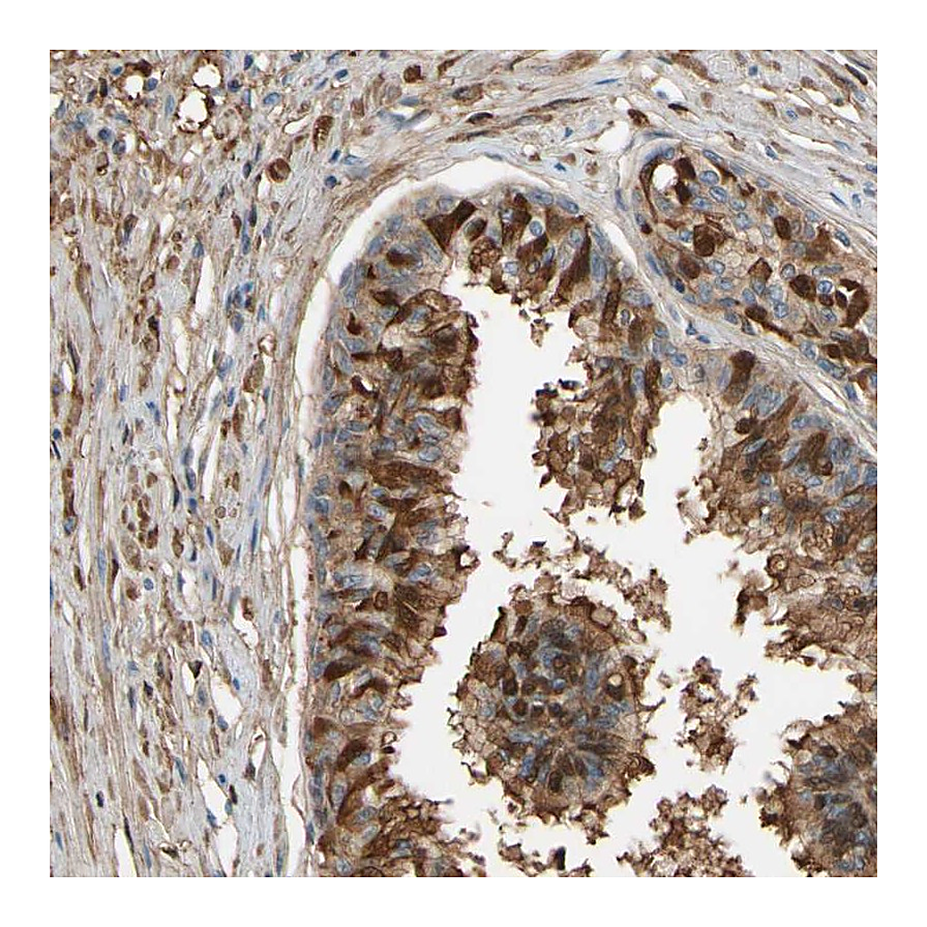 Atlas Antibodies Anti-CSMD2 Antibody