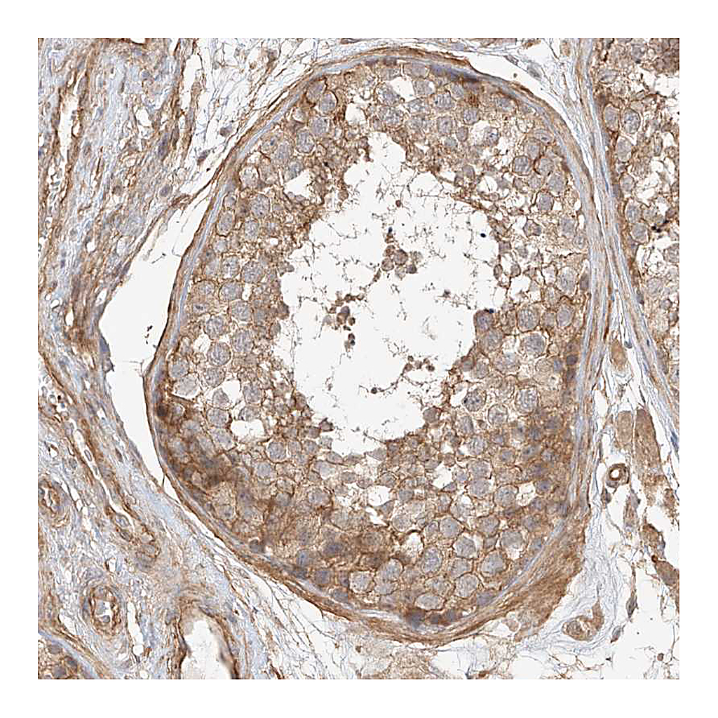 Atlas Antibodies Anti-CSMD3 Antibody