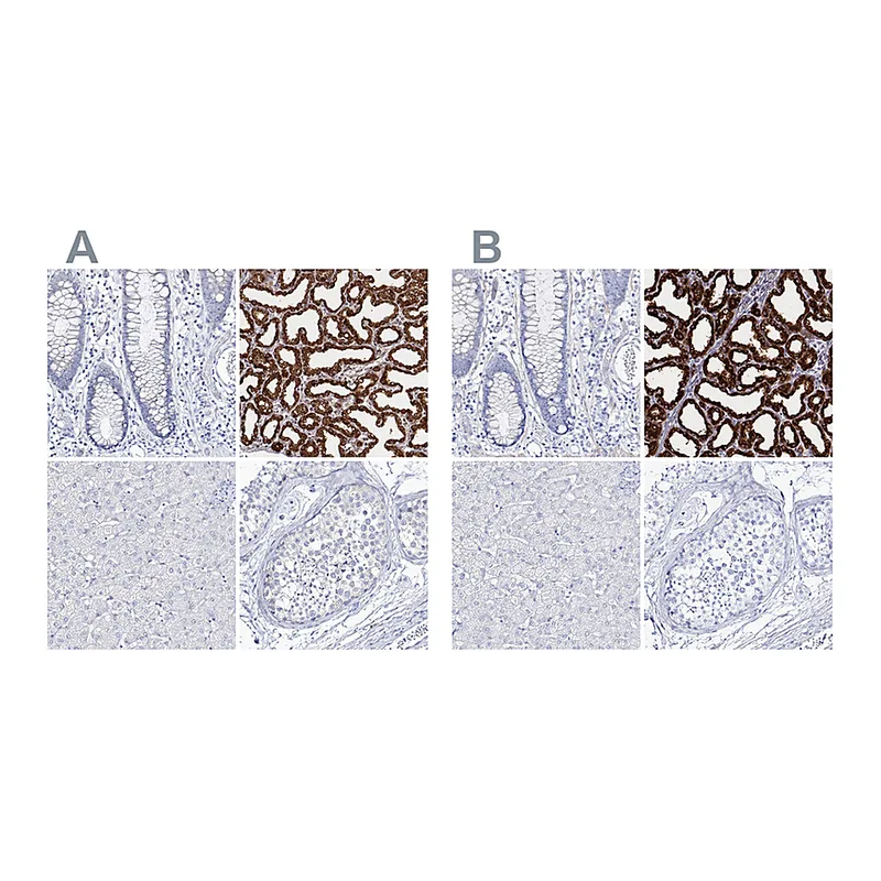 Atlas Antibodies Anti-CSN3 Antibody