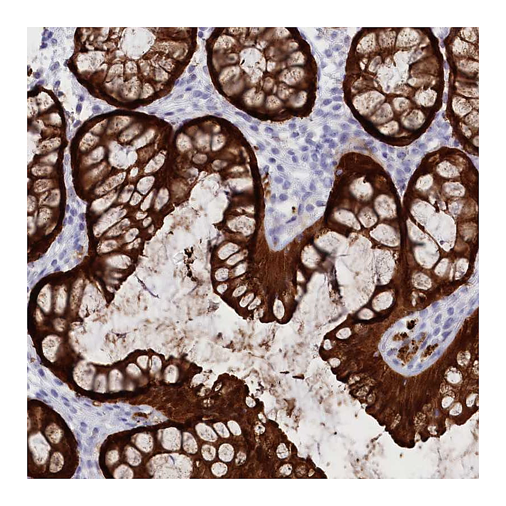 Atlas Antibodies Anti-CSNK1G2 Antibody
