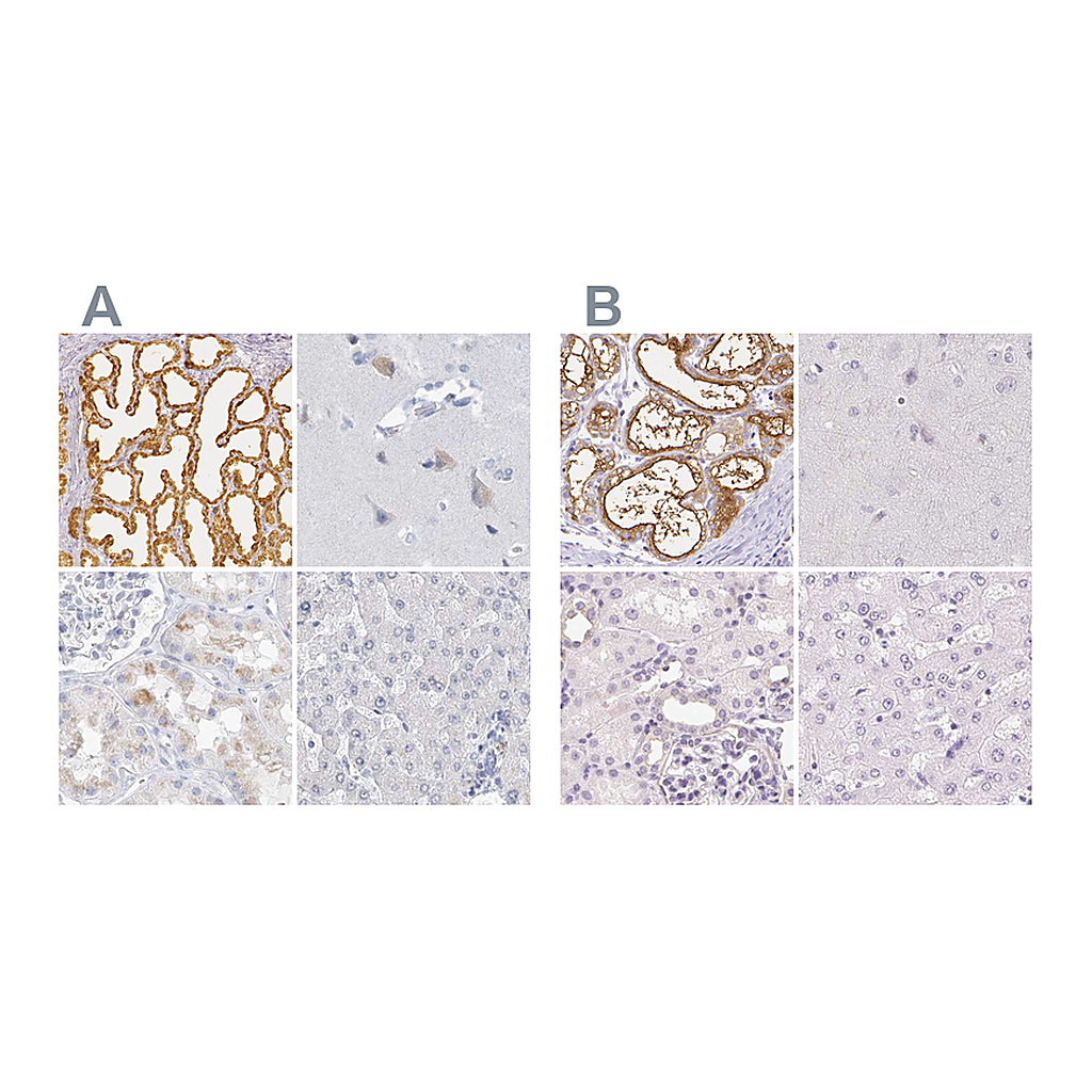Atlas Antibodies Anti-CSN1S1 Antibody