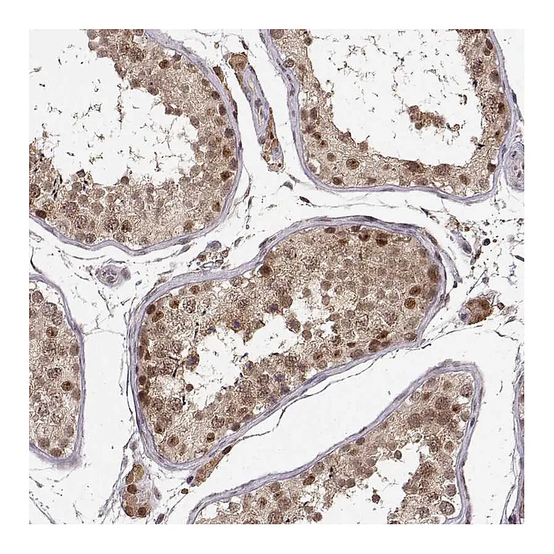 Atlas Antibodies Anti-CSNK2A1 Antibody