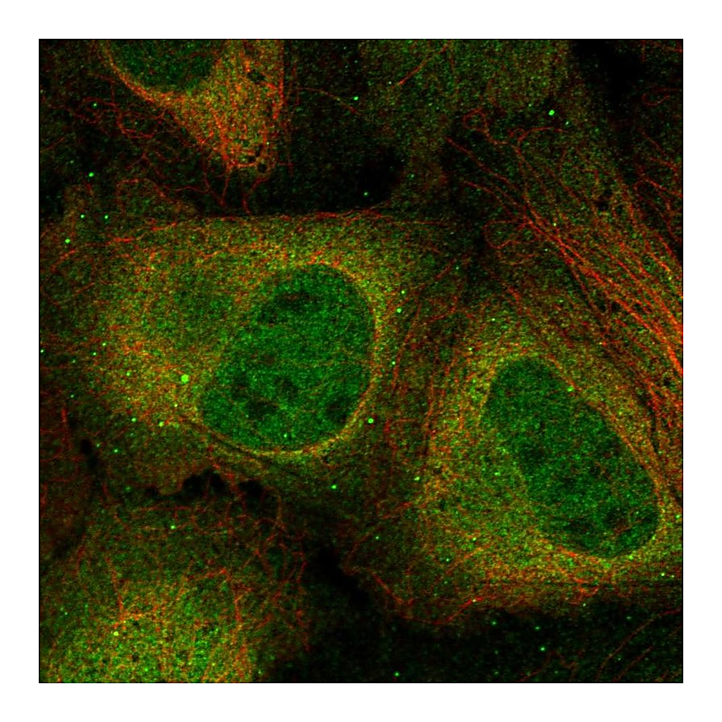 Atlas Antibodies Anti-CSNK2A2 Antibody